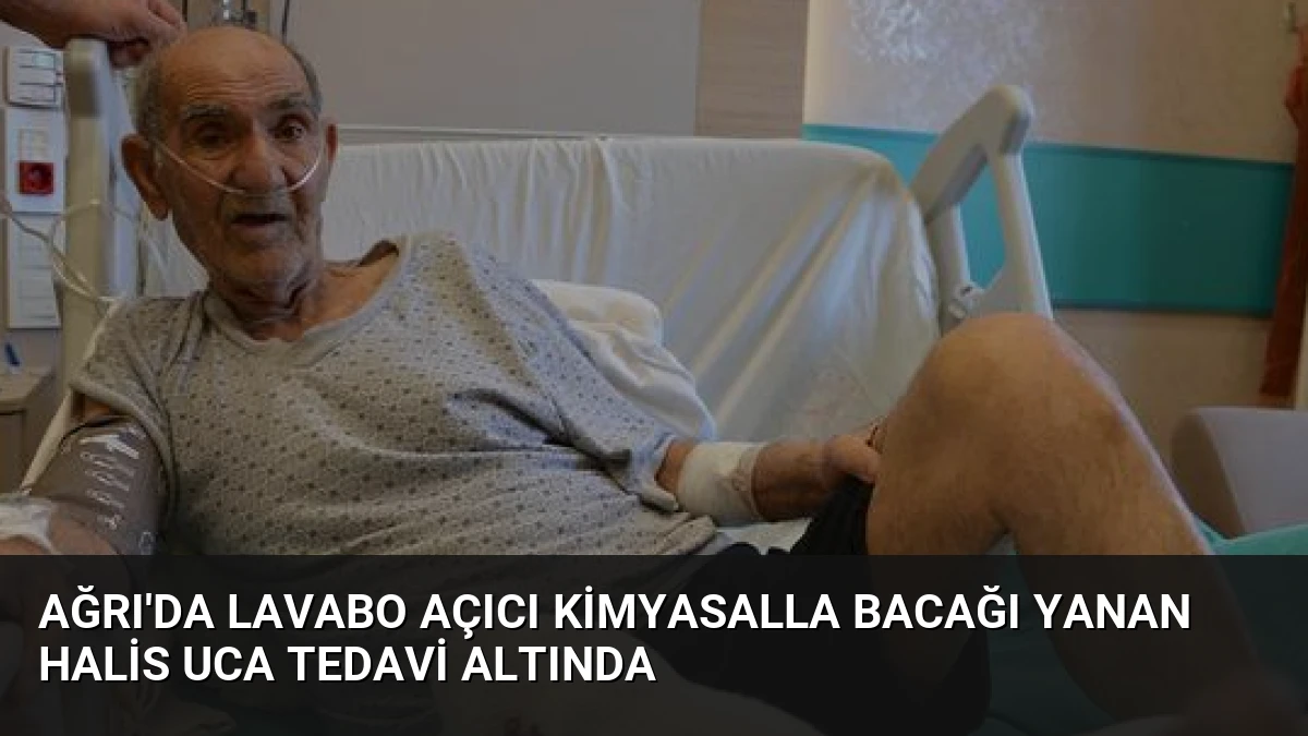Ağrı’da Lavabo Açıcı Kimyasalla Bacağı Yanan Halis Uca Tedavi Altında
