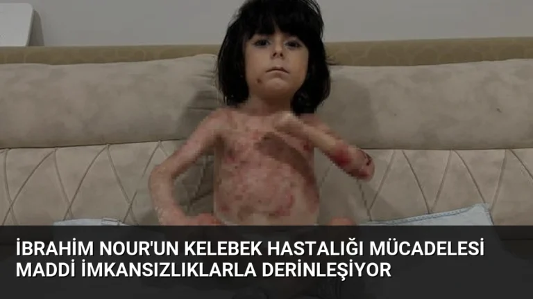 İbrahim Nour’un Kelebek Hastalığı Mücadelesi Maddi İmkansızlıklarla Derinleşiyor