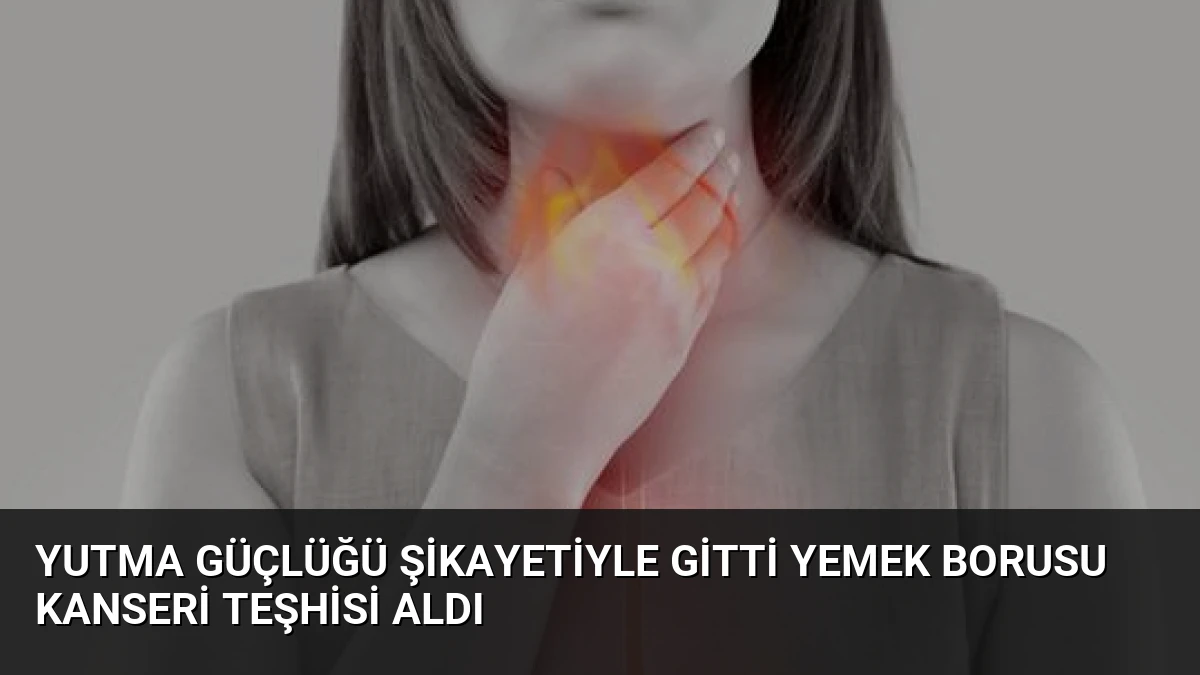 Yutma Güçlüğü Şikayetiyle Gitti Yemek Borusu Kanseri Teşhisi Aldı