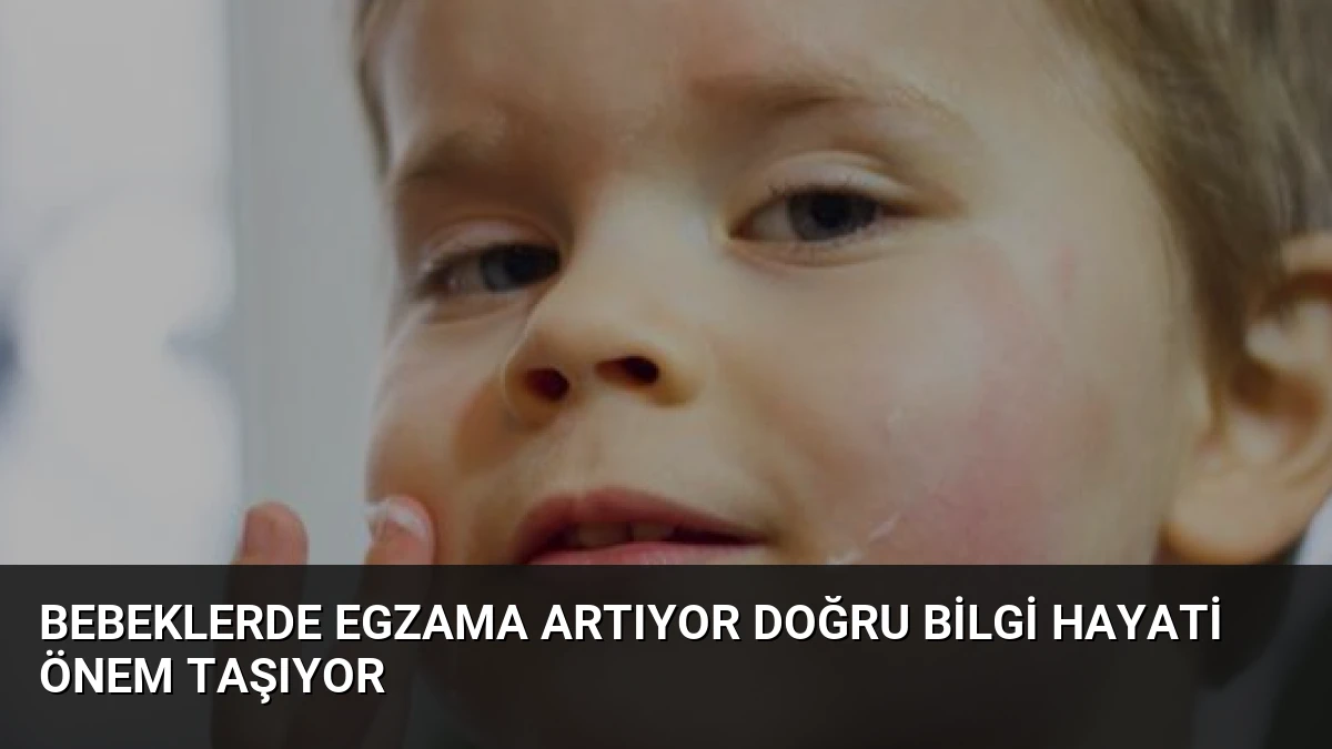 Bebeklerde Egzama Artıyor Doğru Bilgi Hayati Önem Taşıyor