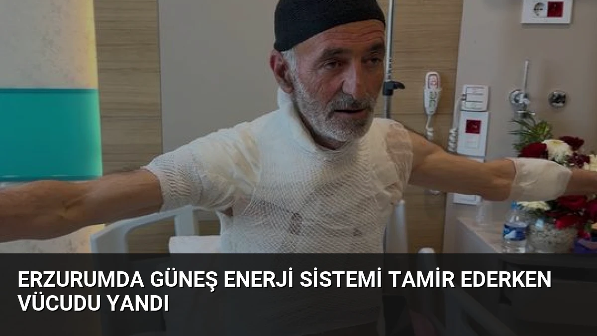 Erzurumda Güneş Enerji Sistemi Tamir Ederken Vücudu Yandı