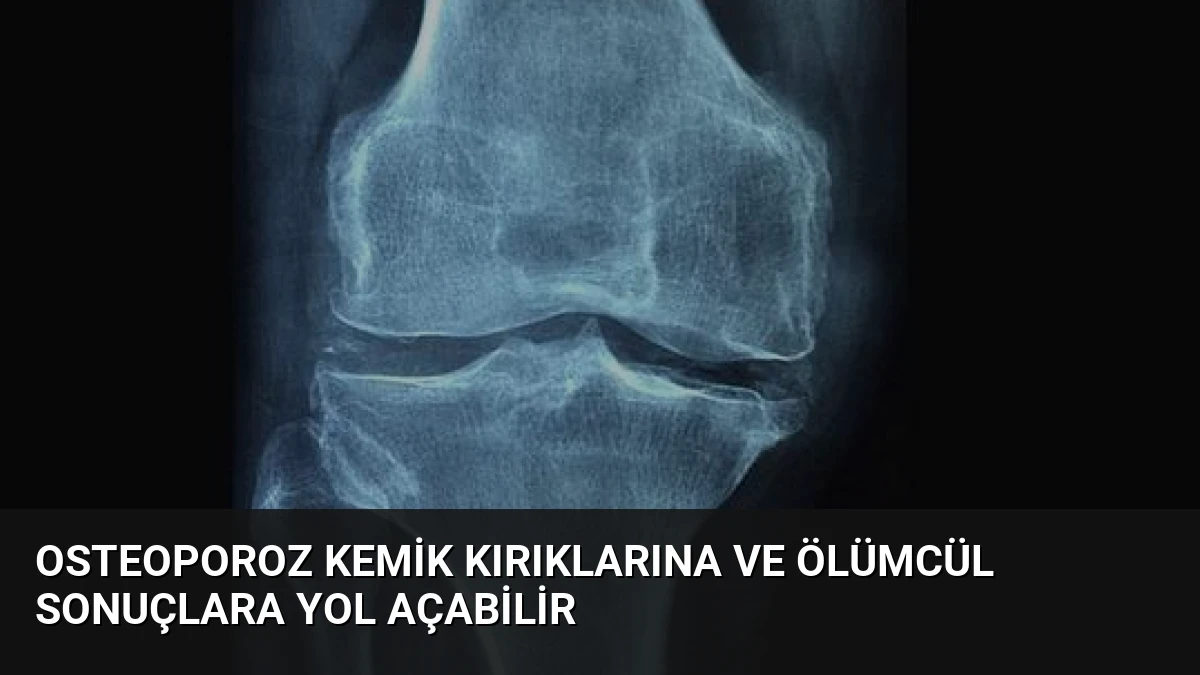Osteoporoz Kemik Kırıklarına ve Ölümcül Sonuçlara Yol Açabilir
