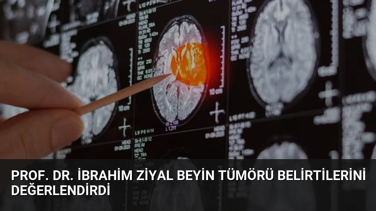 Prof. Dr. İbrahim Ziyal Beyin Tümörü Belirtilerini Değerlendirdi
