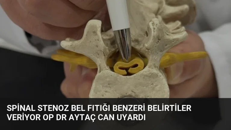Spinal Stenoz Bel Fıtığı Benzeri Belirtiler Veriyor Op Dr Aytaç Can Uyardı