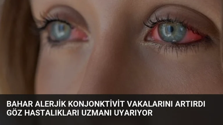Bahar Alerjik Konjonktivit Vakalarını Artırdı Göz Hastalıkları Uzmanı Uyarıyor