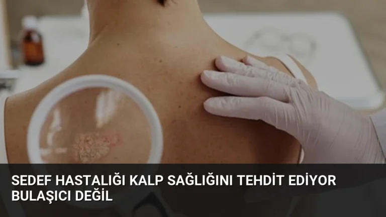 Sedef Hastalığı Kalp Sağlığını Tehdit Ediyor Bulaşıcı Değil