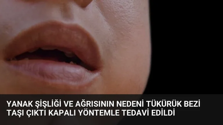 Yanak Şişliği ve Ağrısının Nedeni Tükürük Bezi Taşı Çıktı Kapalı Yöntemle Tedavi Edildi