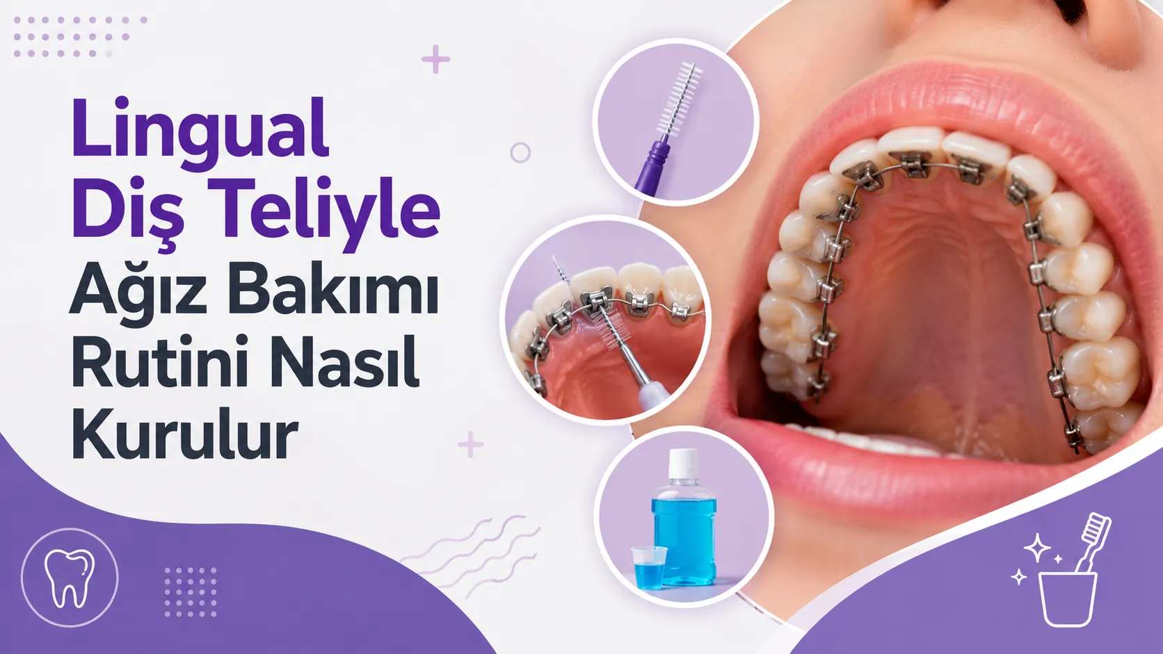Lingual Diş Teliyle Ağız Bakımı Rutini Nasıl Kurulur
